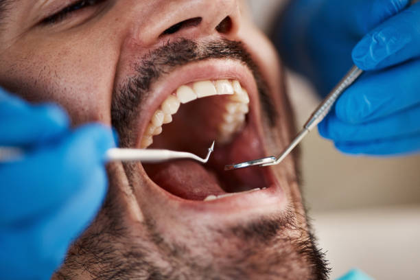 Full Mouth Reconstruction in Rogue River, OR